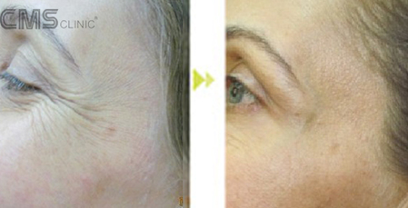 世界微笑日，西美斯支招如何让你的笑容更美丽