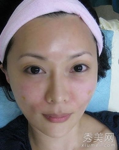 女星陈莉敏整容30次 打美白针险丧命