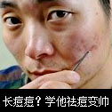 长痘痘？学他四步战痘