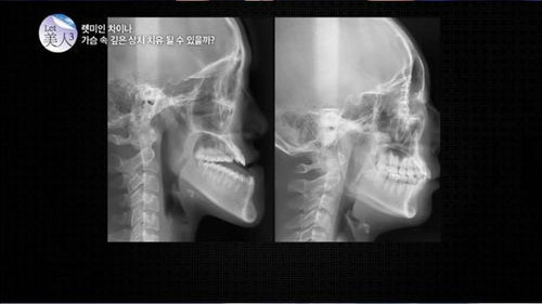 图片来自韩国《朝鲜日报》