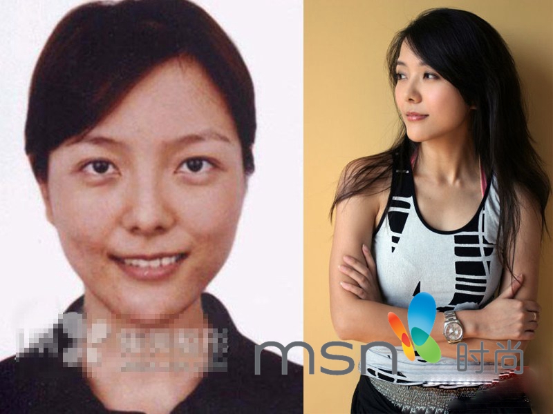 周蕙变高鼻梁大眼妹换脸疑整容 那些厉辩未整容的明星