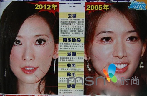 周蕙变高鼻梁大眼妹换脸疑整容 那些厉辩未整容的明星