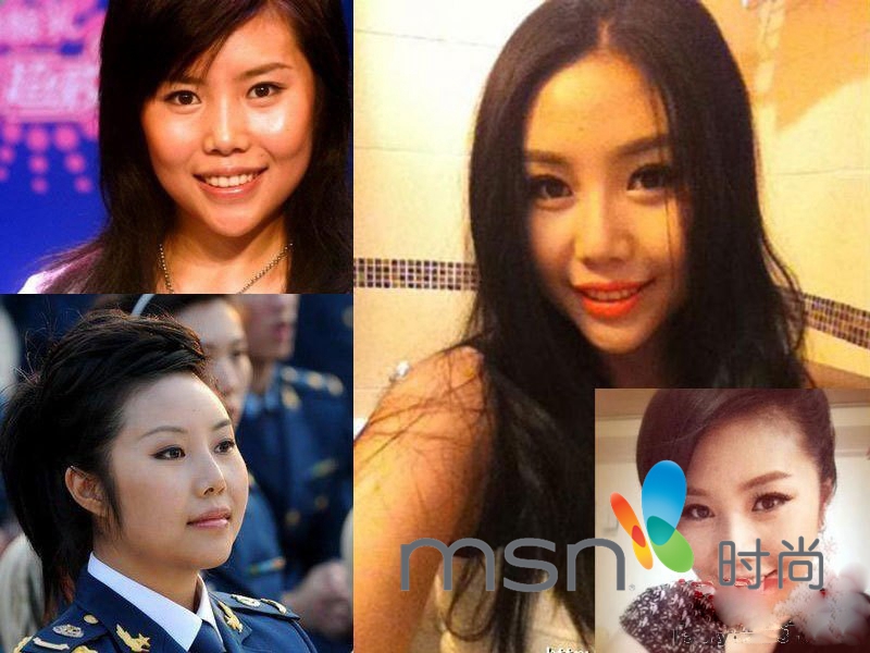 周蕙变高鼻梁大眼妹换脸疑整容 那些厉辩未整容的明星