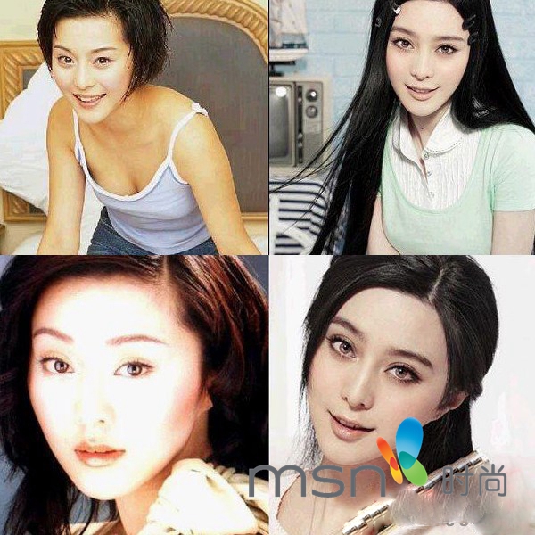 周蕙变高鼻梁大眼妹换脸疑整容 那些厉辩未整容的明星