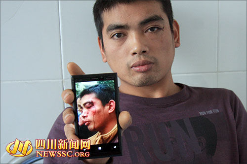 躺在病床上的郑森，相片是事发后朋友帮他拍下的