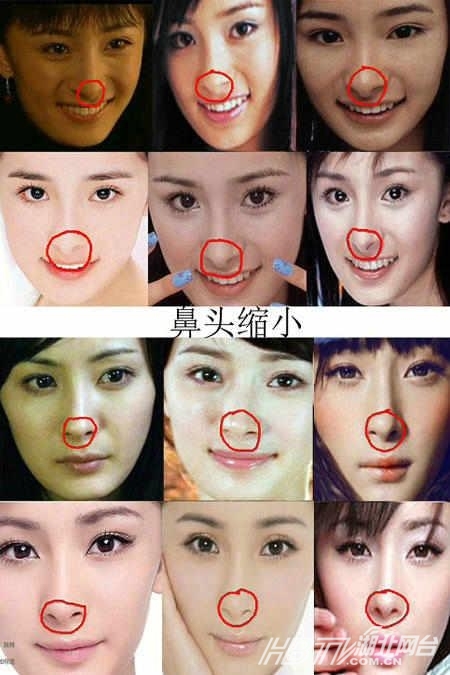 郭美美巨鼻吓人 明星整成僵尸脸