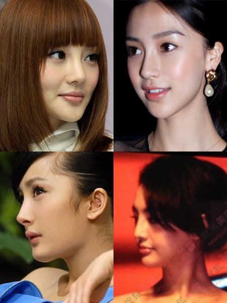 姚笛整容变脸似baby 揭女星整容部位(图)