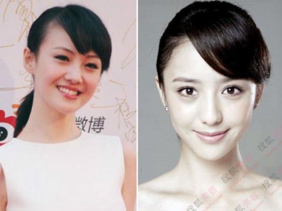 姚笛整容变脸似baby 揭女星整容部位(图)