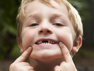关于儿童换牙的7个疑问