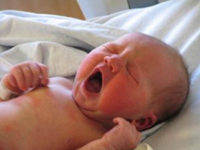 新生儿缺氧的后果及护理