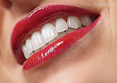 如何科学地美白牙齿？