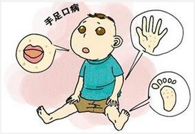 儿童手足口病的日常预防和中医小偏方