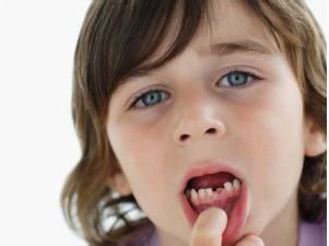 女孩牙齿矫正最佳年龄是11岁