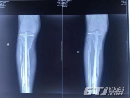 e0638fdccba535e8bd886a8c7d98baa3.jpg 名医院长跳楼自杀成迷:生前曾被蒙面人打断腿