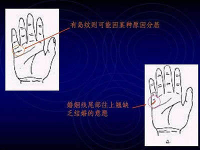 从手纹上看健康的方法